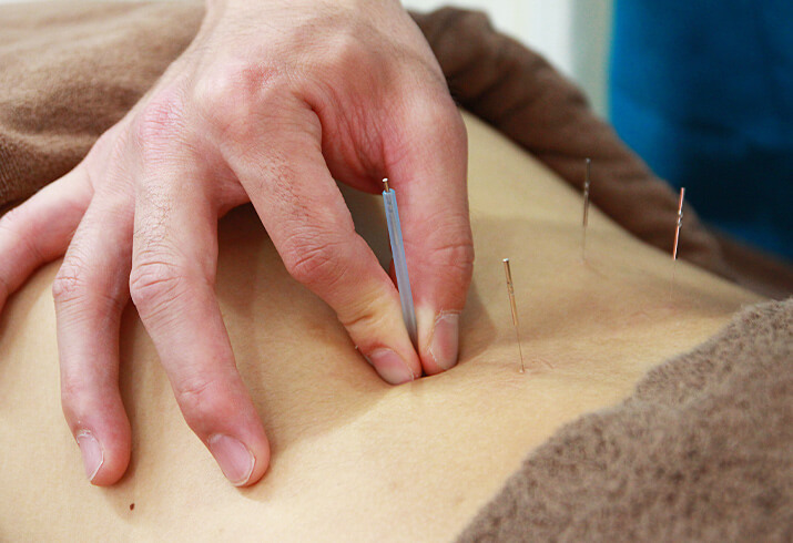 鍼灸 / コンビネーション療法