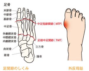 外反母趾について　　　　平野区　マッサージ　整骨院